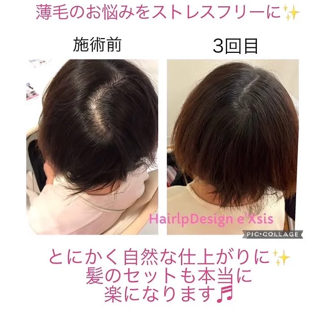 施術ベッドとタオルが整えられた店内の一角